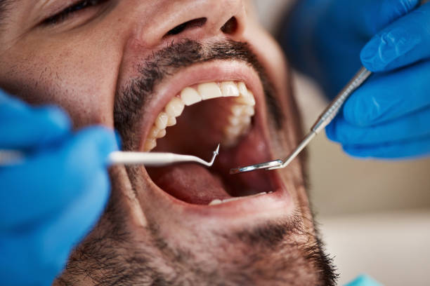 Best Same-Day Emergency Dental Services in Bunker Hill, OR